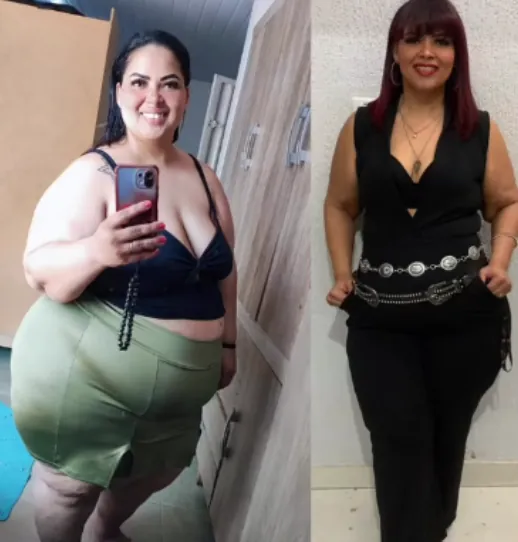 Antes e depois de paciente acompanhada pelo Dr. Wander Carvalho